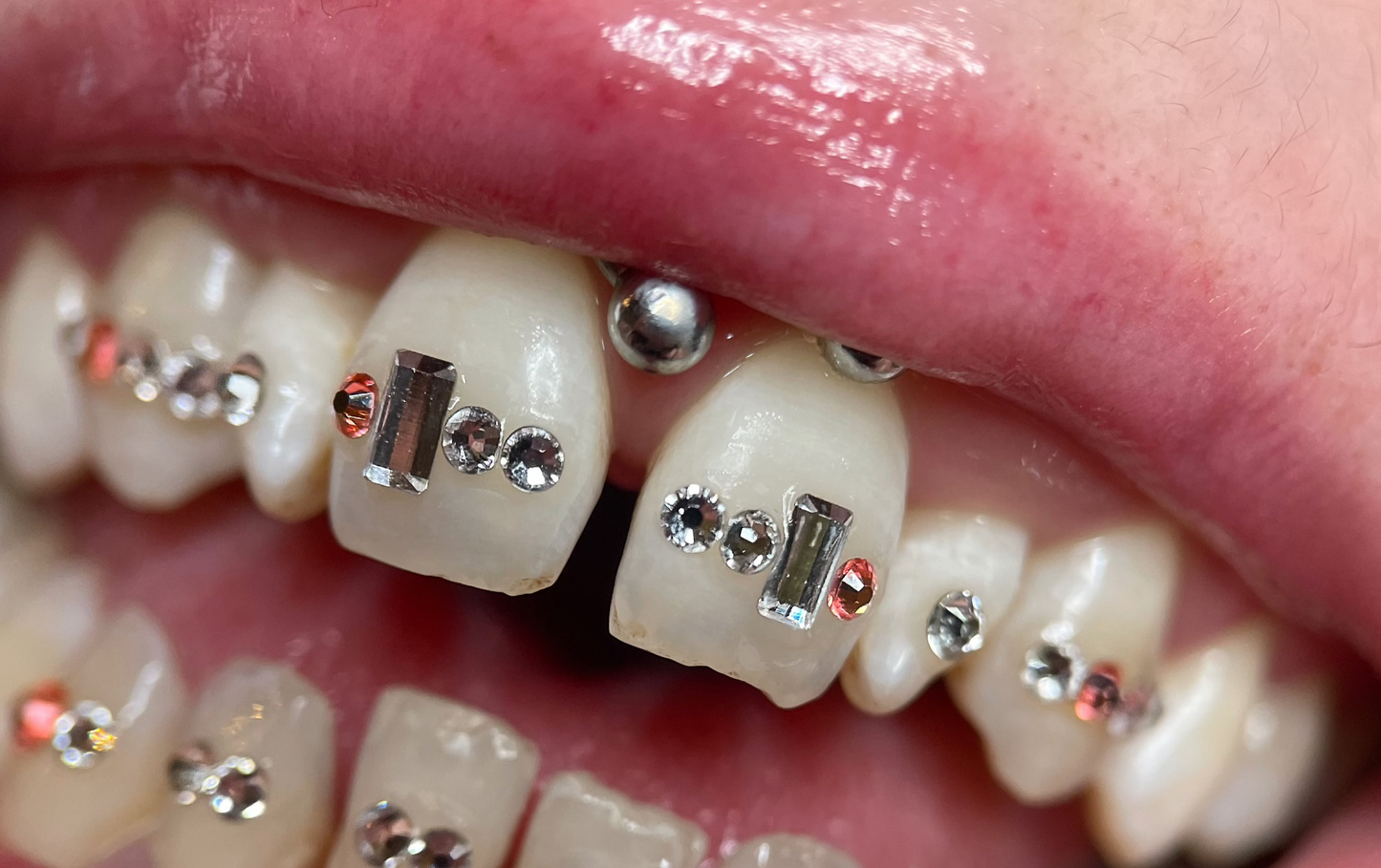 Sourire orné de strass dentaire swarovski, baguette couleur crystal