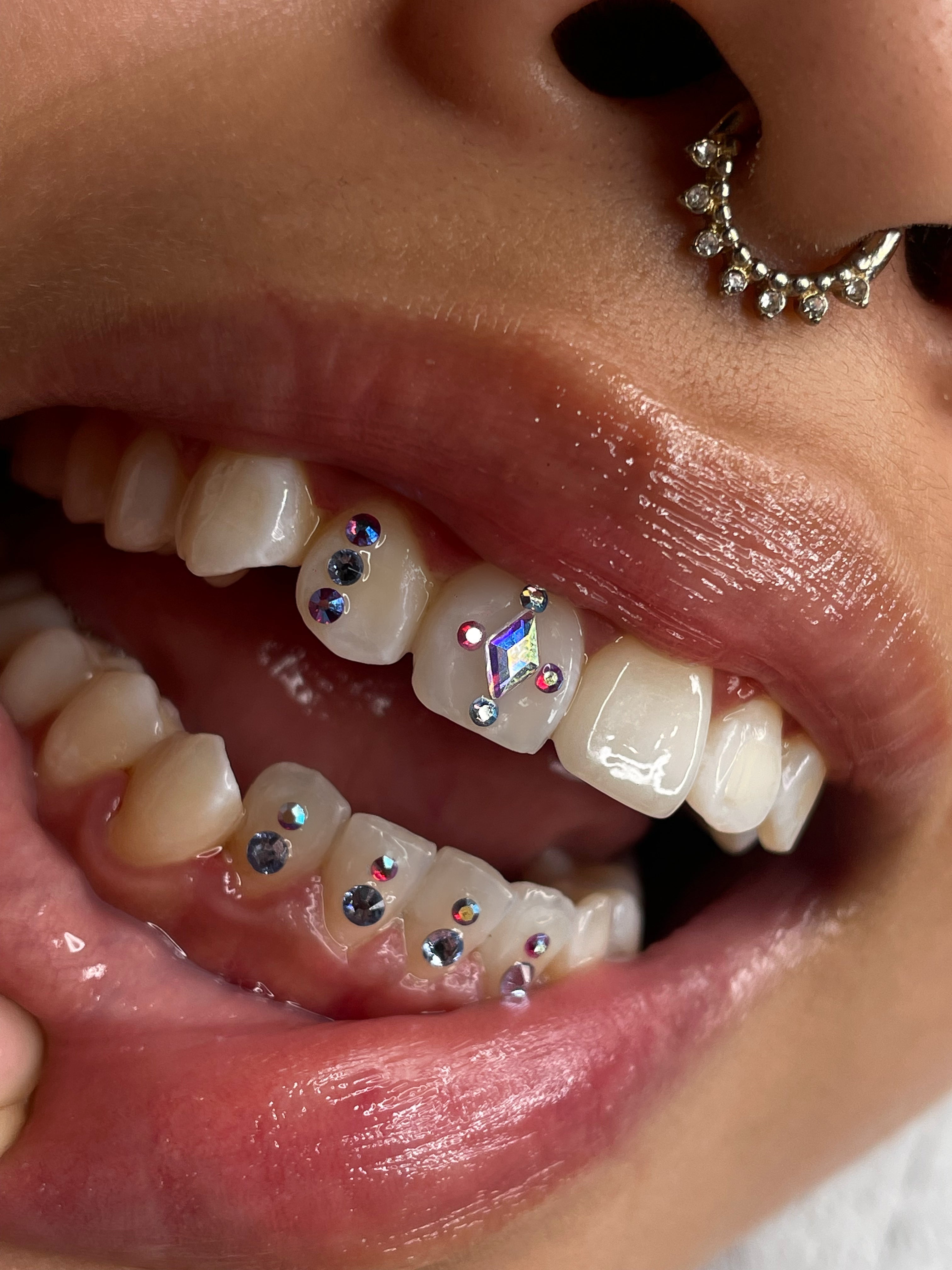sourire orné d'une composition de strass dentaires swarovski. Losange holographic, rond couleur irisée