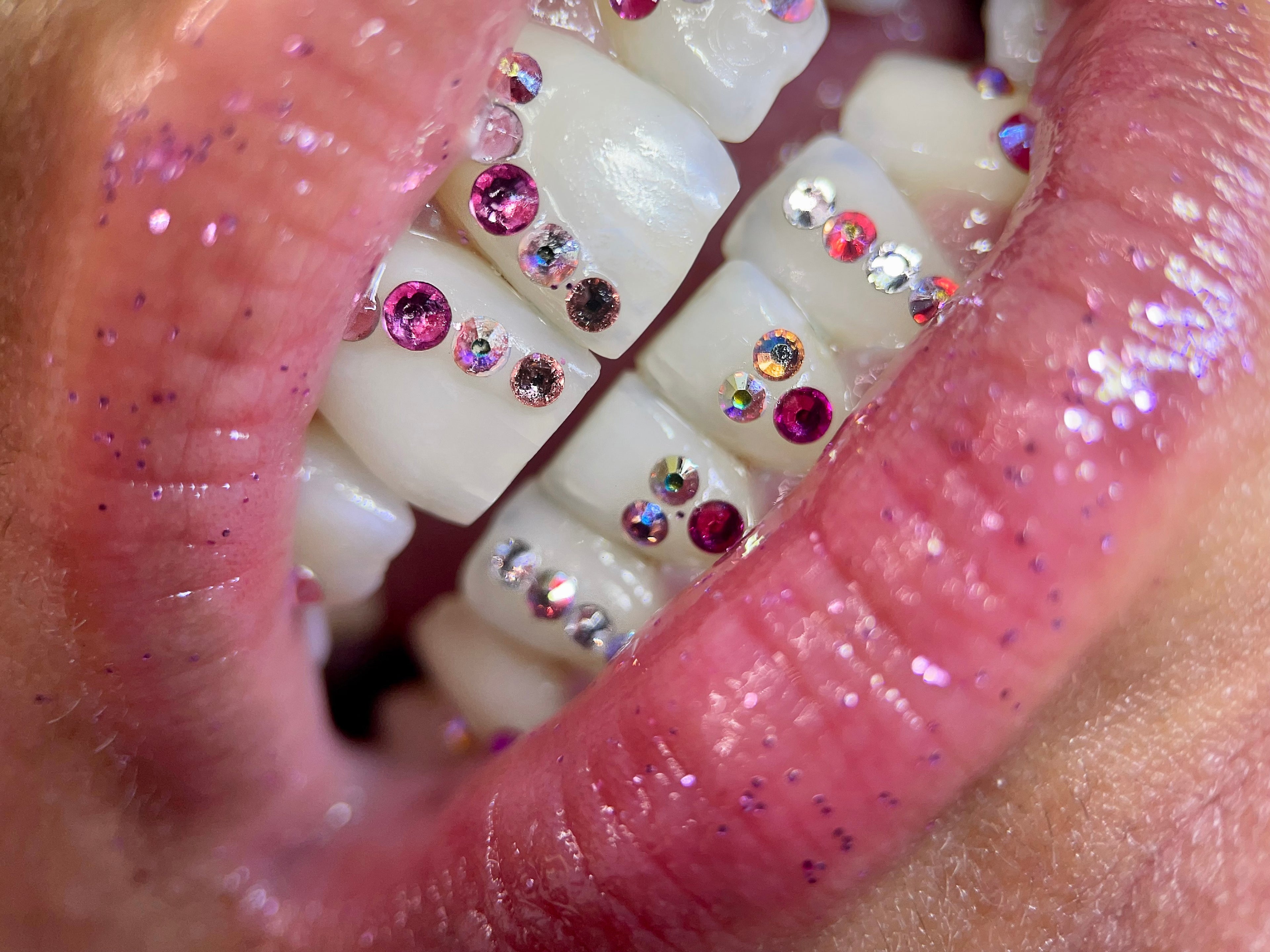 zoom sur sourire avec strass dentaires swarovski de couleurs variées, haute qualité, tenue longue durée