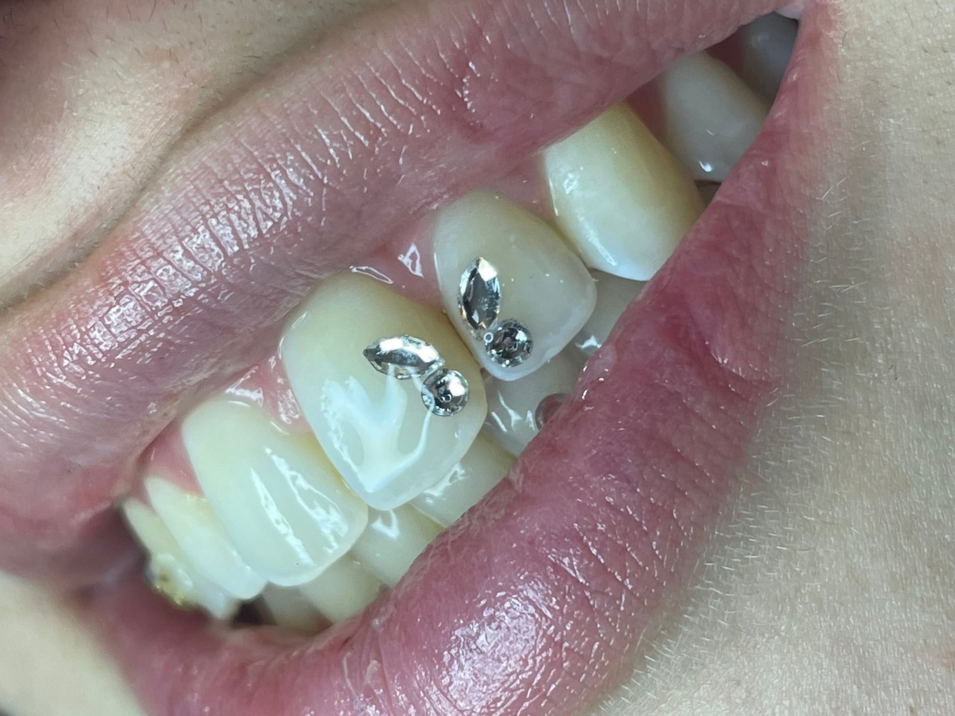 Sourire orné d'un papillon de couleur crystal, strass dentaire swarovski de haute qualité.