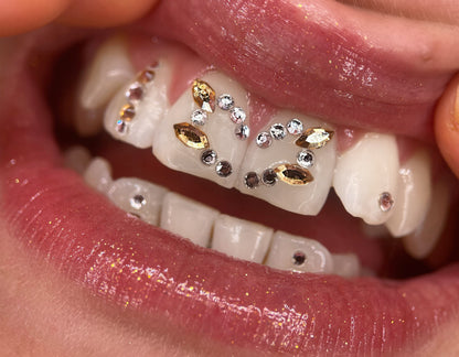 Sourire orné de strass dentaires swarovski couleur champagne en forme de navette