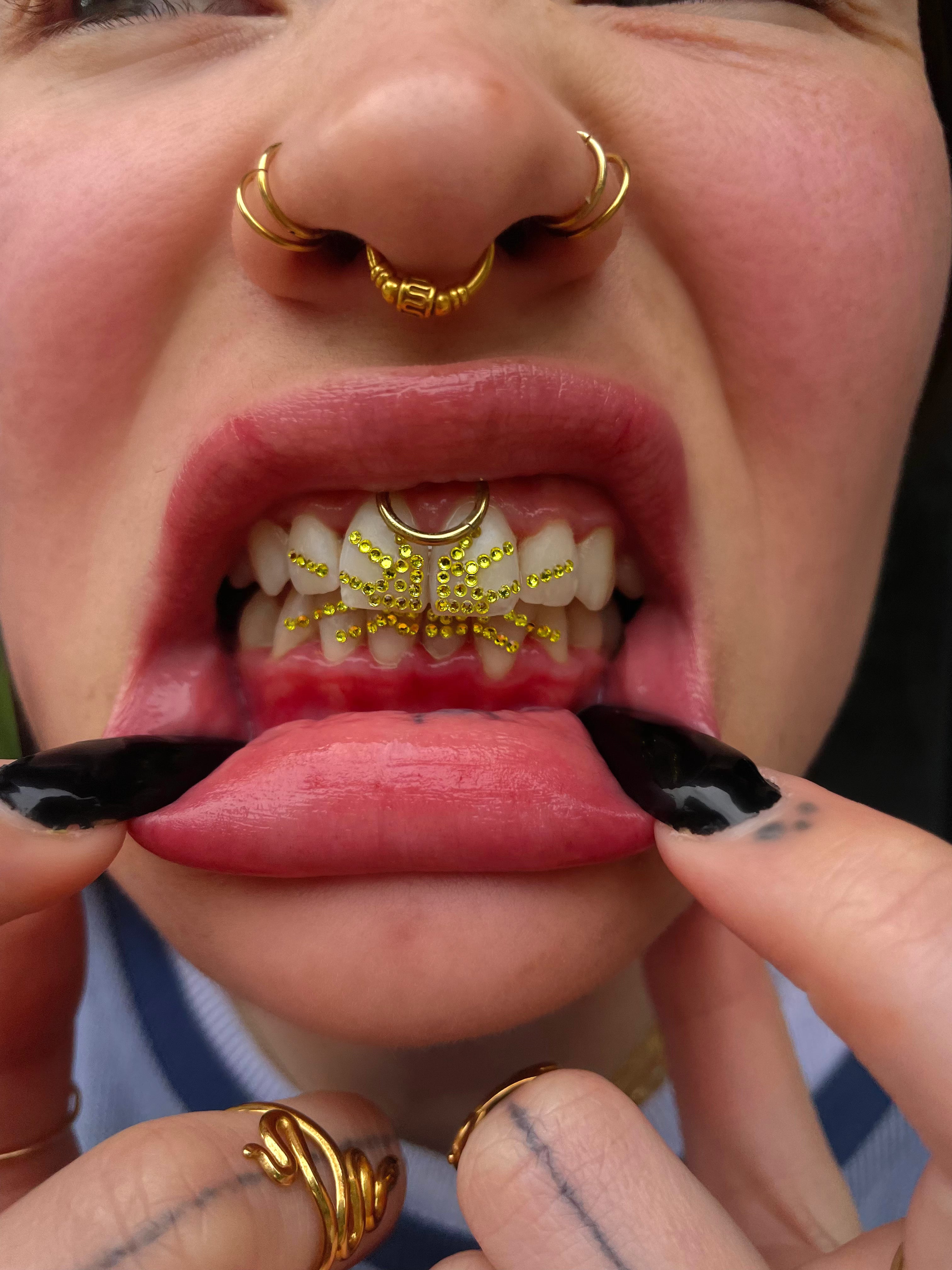 sourire orné d'une composition de strass dentaires swarovski couleur jaune brillant